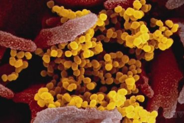 Allergies or COVID? Season allergy season arrives during pandemic