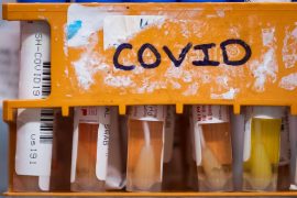 Specimens to be tested for COVID-19 are seen at LifeLabs in B.C. last March.