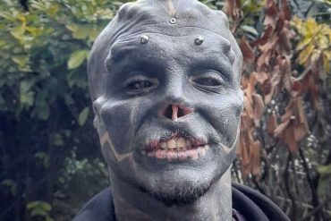 Anthony Lofredo had his nose and ears removed: French want to become "Black Alien" - News Abroad