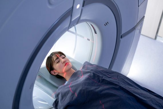 MRI brain scanner distorts perception of space - Spectrum of Science