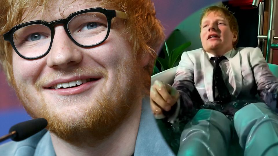 Montage: Singer Ed Sheeran smiles at the camera on the left.  On the right he is sitting in an ice tub.