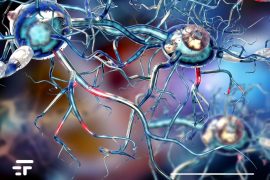 New immunotherapy stopped in multiple sclerosis, phase 1 trials