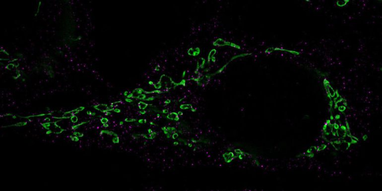 Fragmentation of mitochondria (green): The Drp-1 protein responsible for decay is labeled with antibodies and stained in magenta.