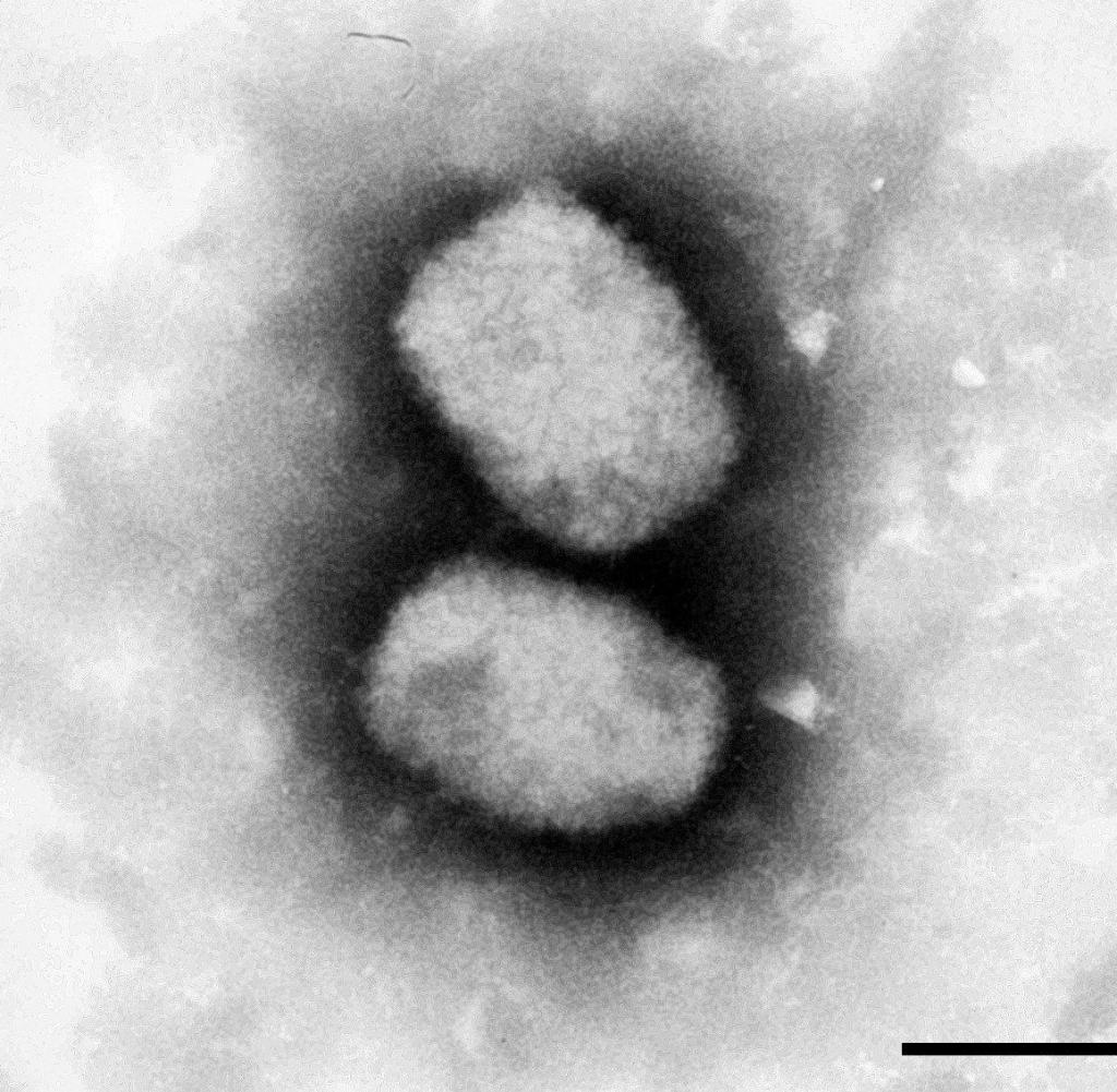 An electron micrograph shows the monkeypox virus.  Seven cases have been reported in the UK