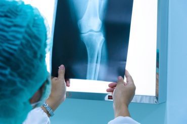 Arthroscopy useless in osteoarthritis of the knee |  medicine transparent
