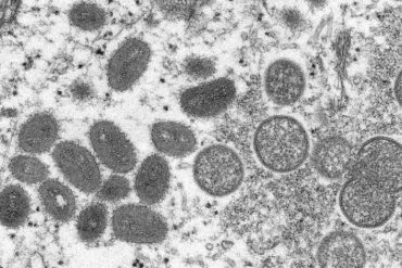 United States expands vaccination campaign against monkeypox - News Augsburg, Allgu and Ulm