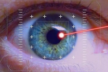 Laser eye surgery trend: what are the methods and what are the risks?