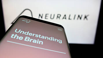 Neuroprosthesis stimulates new connections in the brain  Health City Berlin