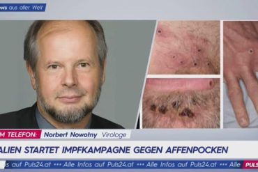 Virologist Norbert Novoti: widespread vaccination against monkeypox is not necessary