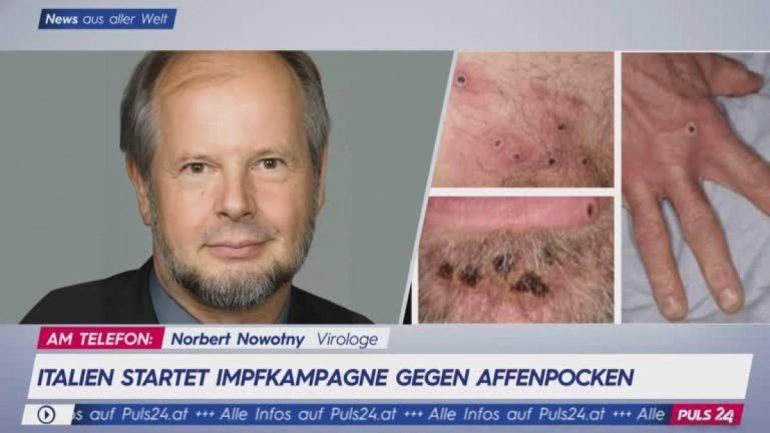 Virologist Norbert Novoti: widespread vaccination against monkeypox is not necessary