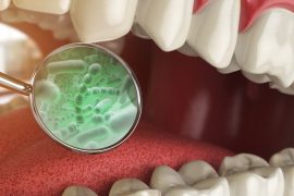 Germs in the mouth fuel cancer growth